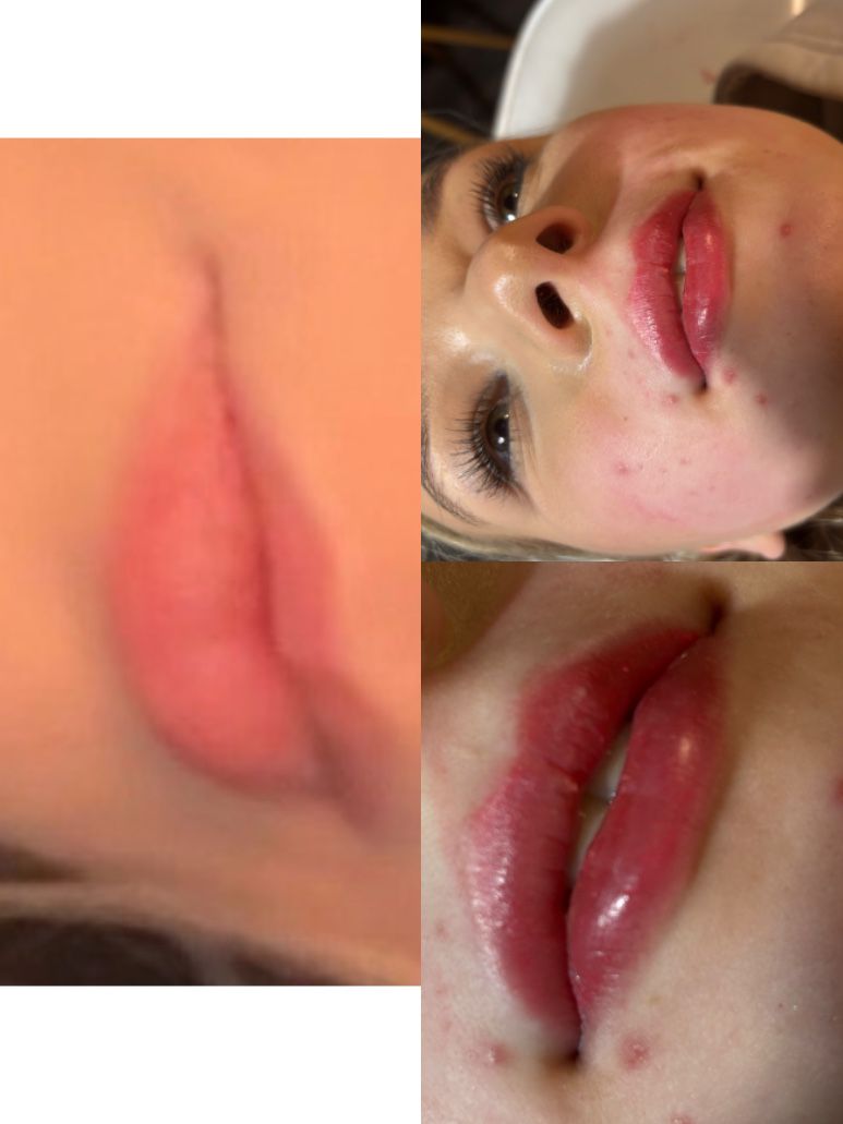 Lip blush — healed result