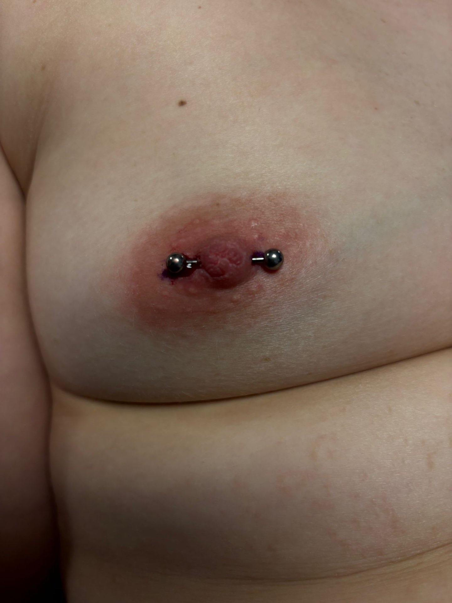 Nipple piercing