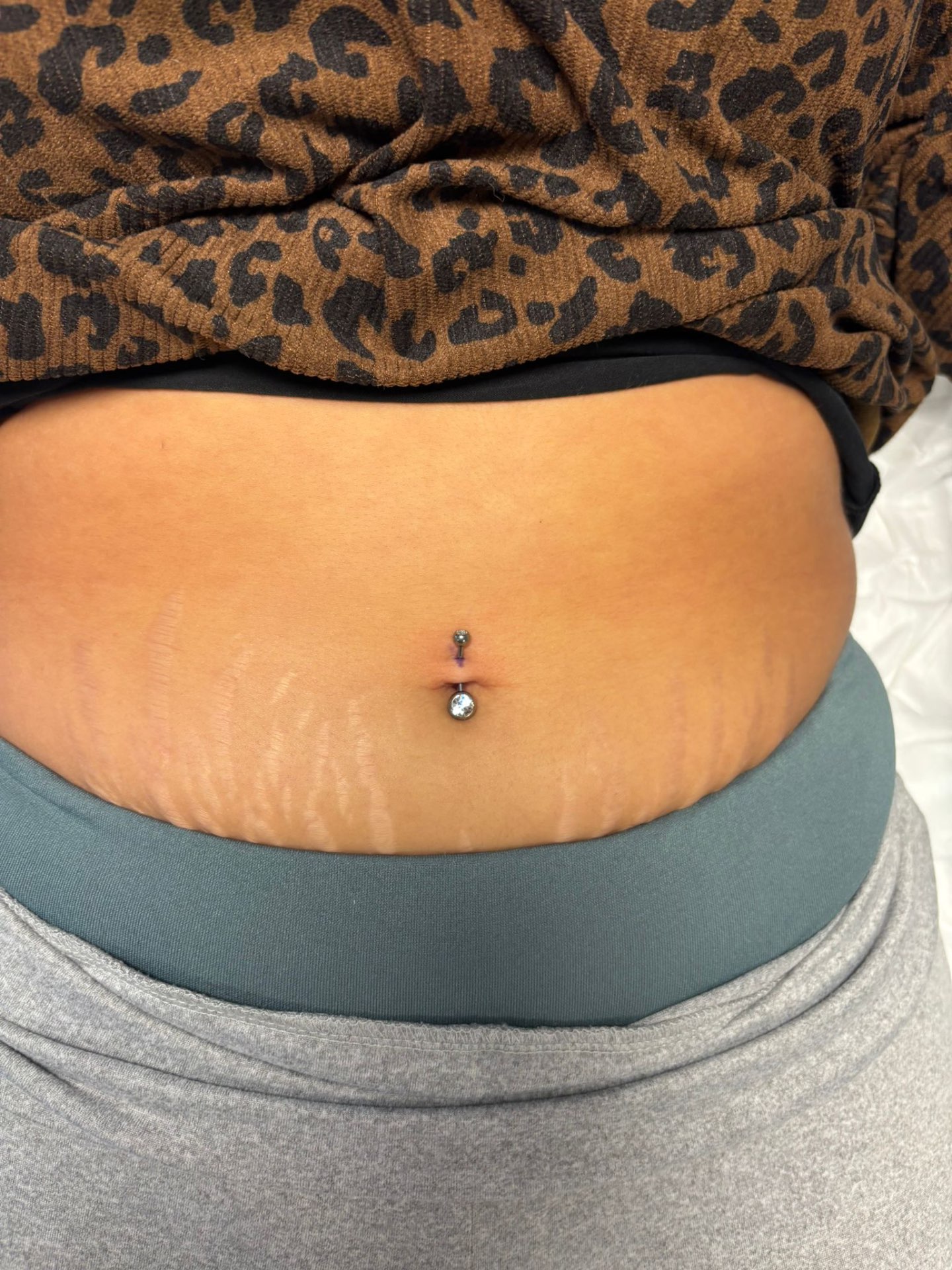 Navelpiercing — fresh